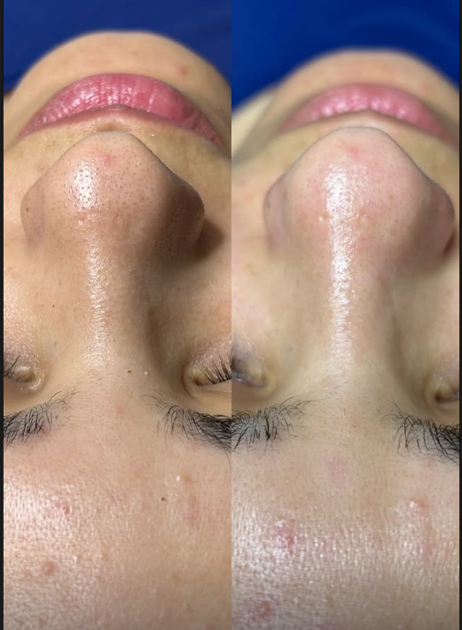 Resultado de tratamento estético 2